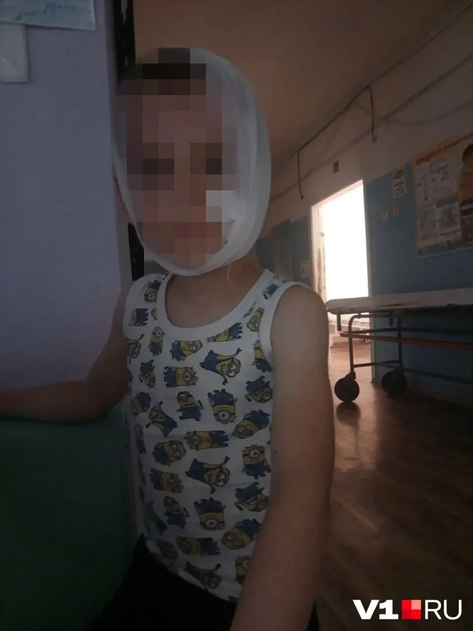 В селе Нижневолжское Светлоярского района бездомное животное напало на пятилетнего ребёнка в День России — мальчик с рваными ранами лица доставлен в медучреждение, жители жалуются на нашествие собак.