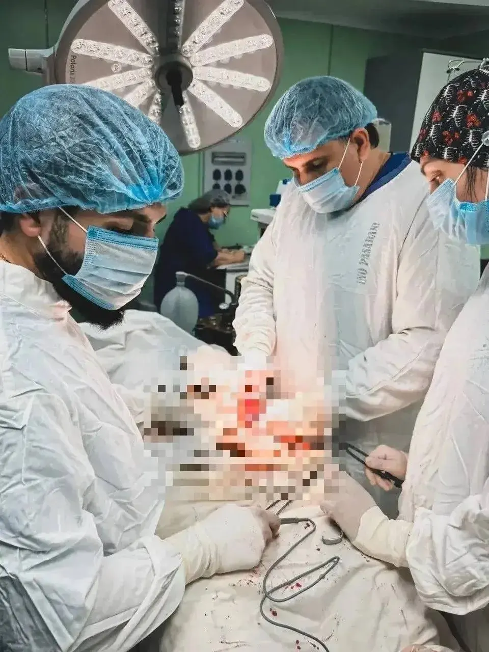 Хирурги краевой клиники выполнили последовательную операцию: вернули органы в брюшную полость и укрепили паховую стенку с помощью сетчатого импланта, что позволило восстановить анатомию и снизить риск рецидива.