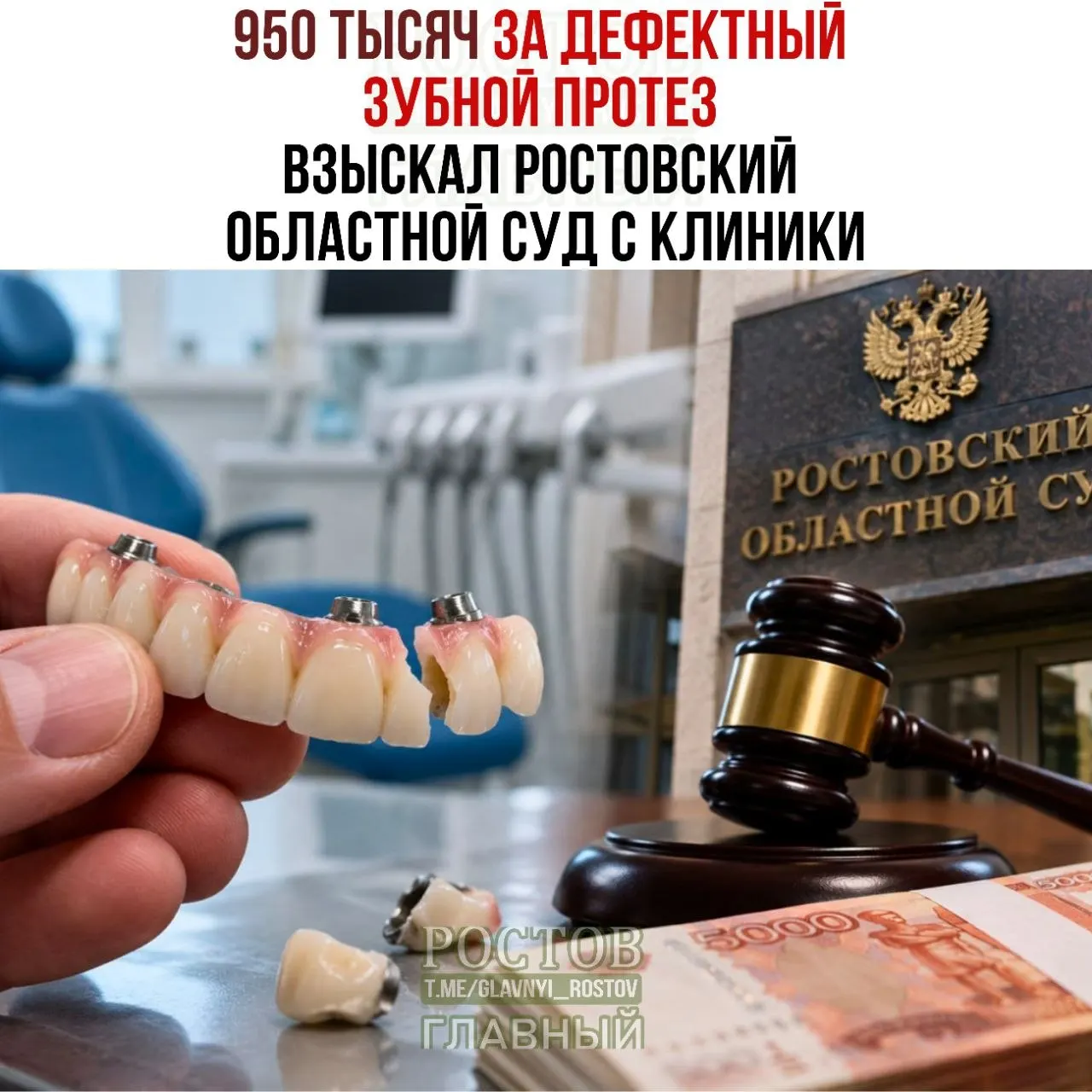После установки четырех имплантов и несъемного протеза возникли проблемы, и суд обязал клинику выплатить почти миллион рублей. Решение осталось в силе после апелляции.